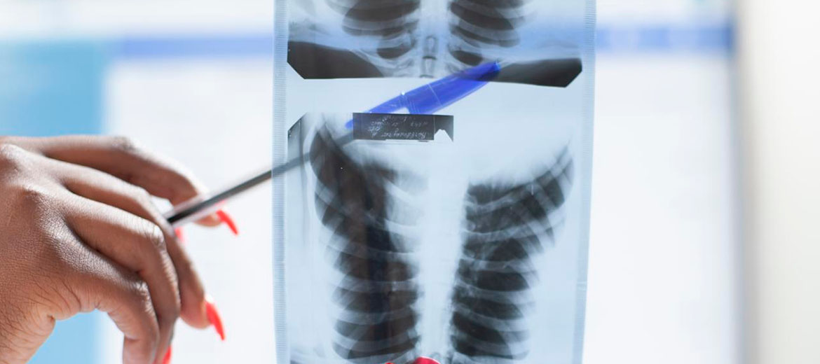 Pleural Procedures