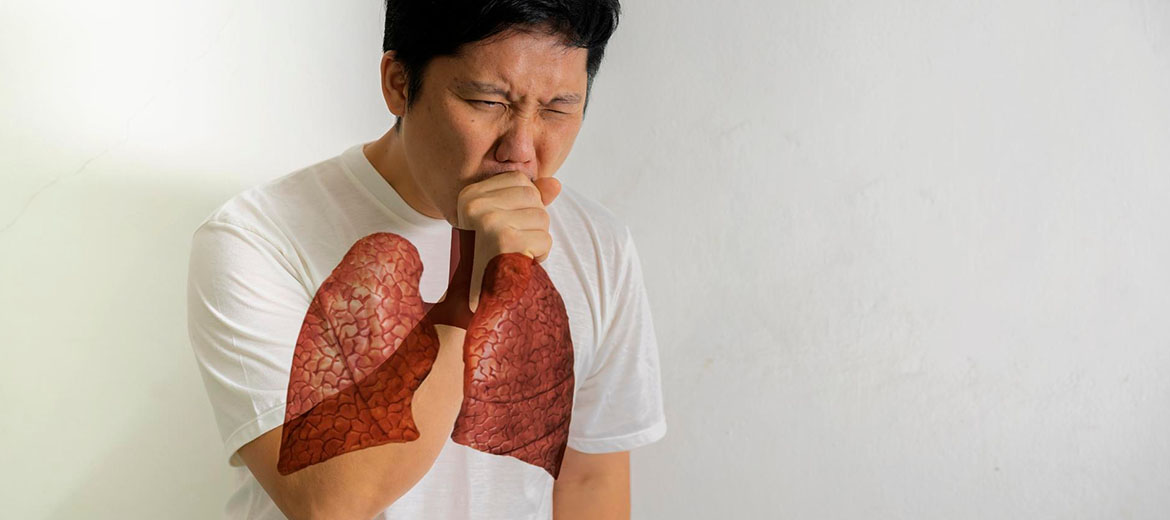 Post TB Lung Damage Treatment