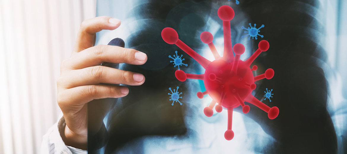 Pulmonary Fibrosis Treatment