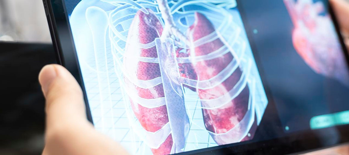 Pulmonary Function Test