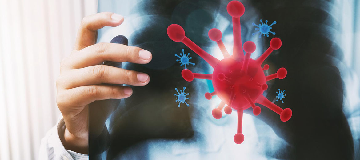 Viral Lung Infections Treatment